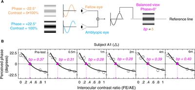 Patching and Suppression in Amblyopia: One Mechanism or Two?